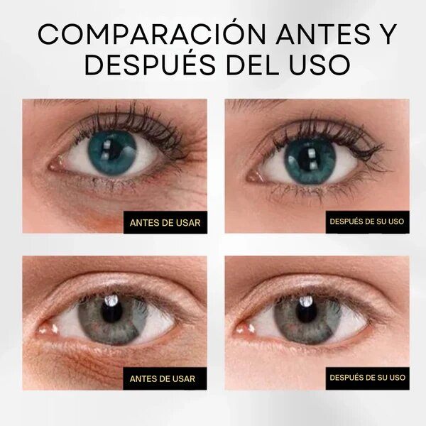 Sérum Quita Ojeras - Edición Limitada 2025 - BeYourGlam®